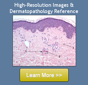 Buy A Systematic Approach to Dermatopathology on Amazon.com